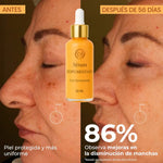 Sérum Despigmentante Facial Dermawhite  – Elimina Manchas en 2 Semanas, Aclara e Ilumina la Piel