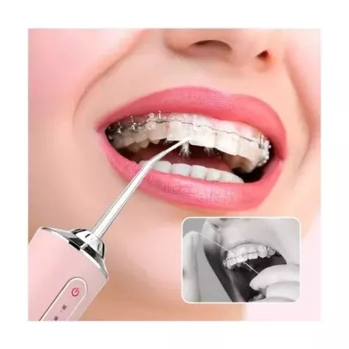 Irrigador Oral™ Dental Portátil Recargable USB 4 Boquillas Limpieza Profunda Encías y Dientes