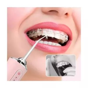Irrigador Oral™ Dental Portátil Recargable USB 4 Boquillas Limpieza Profunda Encías y Dientes