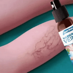 🌿VARICOSE  VEINS ✅ ¡Clínicamente probado para eliminar las venas varicosas + ENVIO GRATIS